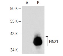  PINX1 (E-9): sc-374115. Western blot analysis of PINX1 expression in non-transfected: sc-110760 (A) and human PINX1 transfected: sc-113229 (B) 293 whole cell lysates.