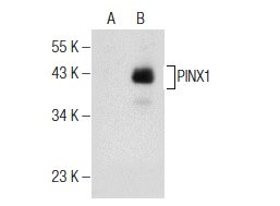  PINX1 (H-8): sc-376394. Western blot analysis of PINX1 expression in non-transfected: sc-110760 (A) and human PINX1 transfected: sc-113229 (B) 293 whole cell lysates.