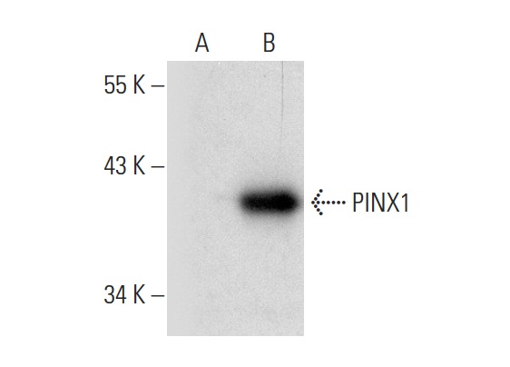  PINX1 (H-150): sc-292115. Western blot analysis of PINX1 expression in non-transfected: sc-110760 (A) and human PINX1 transfected: sc-113229 (B) 293 whole cell lysates.