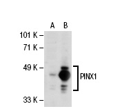  PINX1 (N-13): sc-67769. Western blot analysis of PINX1 expression in non-transfected: sc-110760 (A) and human PINX1 transfected: sc-113229 (B) 293 whole cell lysates.