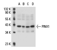  PINX1 (A-15): sc-67765. Western blot analysis of PINX1 expression in Jurkat (A), A-431 (B), A549 (C) and K-562 (D) nuclear extracts.