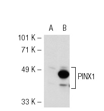  PINX1 (A-15): sc-67765. Western blot analysis of PINX1 expression in non-transfected: sc-110760 (A) and human PINX1 transfected: sc-113229 (B) 293 whole cell lysates.