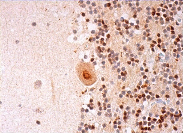  PMS2 (E-19): sc-617. Immunoperoxidase staining of formalin fixed, paraffin-embedded human cerebellum tissue showing nuclear and cytoplasmic staining of Purkinje cells and nuclear staining of cells in granular layer and cells in molecular layer.