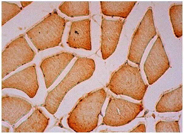  PRAMEF12 (K-19): sc-69221. Immunoperoxidase staining of formalin fixed, paraffin-embedded human skeletal muscle tissue showing cytoplasmic staining of myocytes.