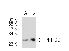  PRTFDC1 (L-23): sc-133928. Western blot analysis of PRTFDC1 expression in non-transfected: sc-110760 (A) and human PRTFDC1 transfected: sc-110979 (B) 293 whole cell lysates.