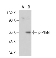  p-PTEN (Ser 380): sc-31714. Western blot analysis of PTEN phsphorylation in non-transfected: sc-117752 (A) and mouse PTEN transfected: sc-122834 (B) 293T whole cell lysates.