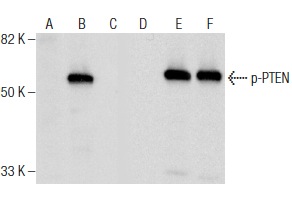  Western blot analysis of PTEN phosphorylation in non-transfected: sc-117752 (A,D), untreated mouse PTEN transfected: sc-122834 (B,E) and lambda protein phosphatase (sc-200312A) treated mouse PTEN transfected: sc-122834 (C,F) 293T whole cell lysates. Antibodies tested include p-PTEN (Ser 380): sc-31714 (A,B,C) and PTEN (N-19): sc-6818 (D,E,F).