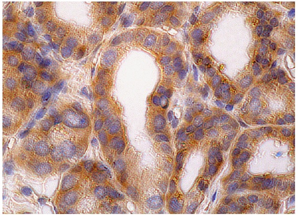  p-PTEN (Ser 380): sc-31714. Immunoperoxidase staining of formalin fixed, paraffin-embedded human seminal vesicle tissue showing cytoplasmic staining of glandular cells.