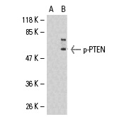  p-PTEN (Ser 380/Thr 382/383): sc-101789. Western blot analysis of phosphorylated PTEN expression in untreated (A) and Calyculin A-treated (B) HT29 whole cell lysates.