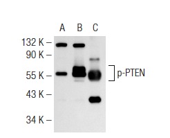  p-PTEN (Ser 380/Thr 382/383): sc-101789. Western blot analysis of PTEN phosphorylation in non-transfected 293T: sc-117752 (A), human PTEN transfected 293T: sc-159790 (B) and WI 38 (C) whole cell lysates.