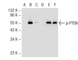  Western blot analysis of PTEN phosphorylation in non-transfected: sc-117752 (A, D), untreated mouse PTEN transfected: sc-122834 (B, E) and lambda protein phosphatase treated mouse PTEN transfected: sc-122834 (C, F) 293T whole cell lysates.  Antibodies tested include p-PTEN (Ser 380/Thr 382/383): sc-101789 (A, B, C) and PTEN (N-19): sc-6818 (D, E, F).