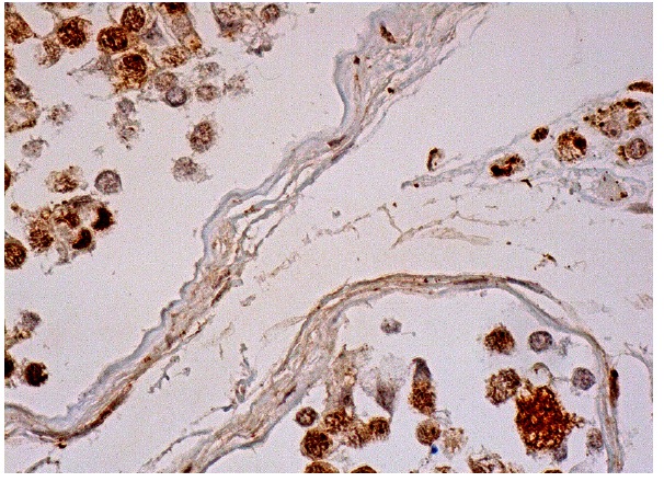  PTTG (H-160): sc-22772. Immunoperoxidase staining of formalin fixed, paraffin-embedded human testis tissue showing nuclear staining of cells in seminiferous ducts and Leydig cells.