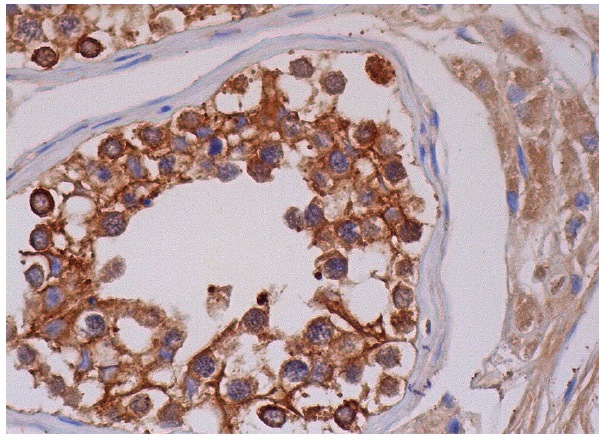  PTTG (DCS-280): sc-56207. Immunoperoxidase staining of formalin fixed, paraffin-embedded human testis tissue showing cytoplasmic and membrane staining of cells in seminiferous ducts and cytoplasmic staining of Leydig cells.