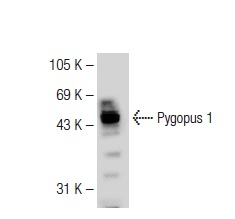  Pygopus 1 (H-162): sc-98662. Western blot analysis of Pygopus 1 expression in JAR whole cell lysate.