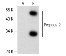  Pygopus 2 (B-4): sc-373994. Western blot analysis of Pygopus 2 expression in non-transfected: sc-117752 (A) and mouse Pygopus 2 transfected: sc-122857 (B) 293T whole cell lysates.