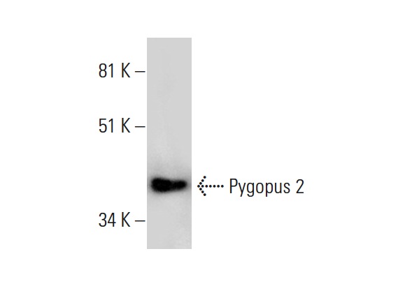  Pygopus 2 (B-12): sc-390506. Western blot analysis of Pygopus 2 expression in JEG-3 whole cell lysate.