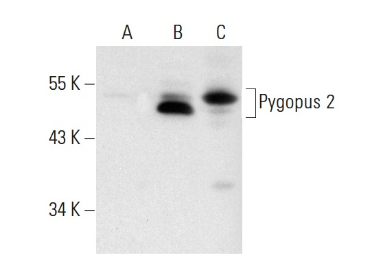  Pygopus 2 (A-17): sc-74876. Western blot analysis of Pygopus 2 expression in non-transfected 293T: sc-117752 (A), mouse Pygopus 2 transfected 293T: sc-122857 (B) and JAR (C) whole cell lysates.