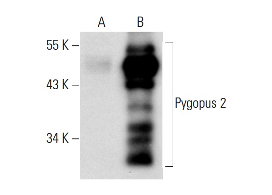  Pygopus 2 (H-216): sc-98744. Western blot analysis of Pygopus 2 expression in non-transfected: sc-117752 (A) and mouse Pygopus 2 transfected: sc-122857 (B) 293T whole cell lysates.