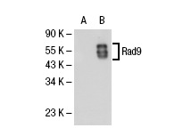  Rad9 (C-20): sc-10465. Western blot analysis of Rad9 expression in non-transfected: sc-117752 (A) and human Rad9 transfected: sc-113776 (B) 293T whole cell lysates.