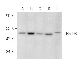  Rad9B (T-12): sc-109415. Western blot analysis of Rad9B expression in NIH/3T3 (A), F9 (B), CTLL-2 (C) and M1 (D) whole cell lysates and rat testis tissue extract (E).