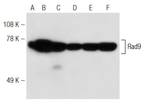  Rad9 (B-8): sc-74464. Western blot analysis of Rad9 expression in HeLa (A), KNRK (B), NIH/3T3 (C), A-431 (D), PC-3 (E) and CCRF-CEM (F) nuclear extracts.