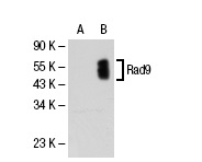  Rad9 (M-389): sc-8324. Western blot analysis of Rad9 expression in non-transfected: sc-117752 (A) and human Rad9 transfected: sc-113776 (B) 293T whole cell lysates.