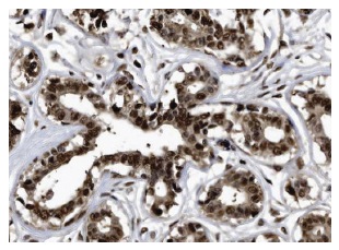  Rad23B (H-120): sc-67225. Immunoperoxidase staining of formalin fixed, paraffin-embedded human breast tissue showing nuclear staining of glandular cells at high magnification. Kindly provided by The Swedish Human Protein Atlas (HPA) program.