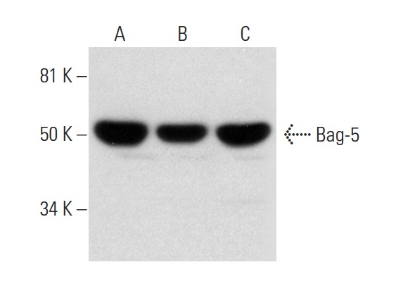  Bag-5 (F-9): sc-390832. Western blot analysis of Bag-5 expression in Jurkat (A), HeLa (B) and MOLT-4 (C) whole cell lysates.