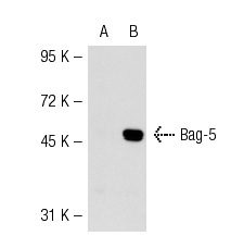  Bag-5 (18Z): sc-101215. Western blot analysis of Bag-5 expression in non-transfected: sc-117752 (A) and mouse Bag-5 transfected: sc-118669 (B) 293T whole cell lysates.