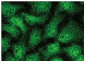  BAG-6 (D-1): sc-365928. Immunofluorescence staining of methanol-fixed HeLa cells showing nuclear and cytoplasmic localization.