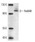  Rad54B (N-16): sc-5852. Western blot analysis of Rad54B expression in UV-irradiated HeLa cells.