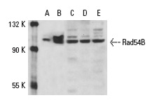  Rad54B (N-16): sc-5852. Western blot analysis of Rad54B expression in non-transfected 293: sc-110760 (A), human Rad54B transfected 293: sc-110613 (B), CCRF-CEM (C) and DU 145 (D) whole cell lysates and HeLa nuclear extract (E).