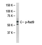  p-Rad9 (Ser 277): sc-130213. Western blot analysis of p-Rad9 expression in Y79 whole cell lysate.