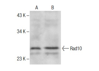  Rad10 (yN-17): sc-26237. Western blot analysis of Rad10 expression in Saccharomyces cerevisiae yeast 20 μ (A) and Saccharomyces cerevisiae yeast 40 μ (B) whole cell lysates.