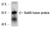  Rad50 (y-300): sc-32862. Western blot analysis of yeast recombinant Rad50 fusion protein.