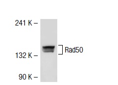  Rad50 (yQ-20): sc-30566. Western blot analysis of Rad50 expression in K-562 whole cell lysate.