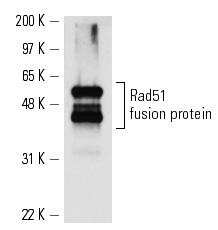  Rad51 (y-180): sc-33626. Western blot analysis of yeast recombinant Rad51 fusion protein.