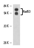  Rad53 (A-9): sc-74427. Western blot analysis of Yeast recombinant Rad53 fusion protein.