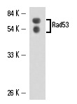  Rad53 (B-6): sc-74426. Western blot analysis of yeast recombinant Rad53 fusion protein.