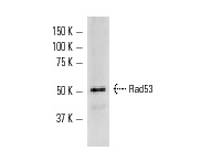  Rad53 (y-300): sc-20169. Western blot analysis of yeast recombinant Rad53 fusion protein.