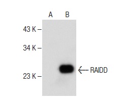  RAIDD (G-7): sc-377080. Western blot analysis of RAIDD expression in non-transfected: sc-117752 (A) and mouse RAIDD transfected: sc-122950 (B) 293T whole cell lysates.