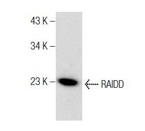  RAIDD (G-7): sc-377080. Western blot analysis of RAIDD expression in K-562 whole cell lysate.