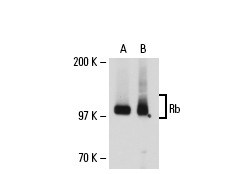  Rb (C-2): sc-74562. Western blot analysis of Rb expression in A-431 (A) and SK-MEL-28 (B) whole cell lysates.