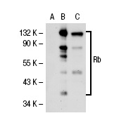  Rb (XZ55): sc-65230. Western blot analysis of Rb expression in A-431 (A) and K-562 (B) whole cell lysates.