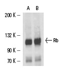  Rb (XZ55): sc-65230. Western blot analysis of Rb expression in A-431 (A) and K-562 (B) whole cell lysates.