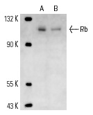  Rb (XZ55): sc-65230. Western blot analysis of Rb expression in A-431 (A) and K-562 (B) whole cell lysates.