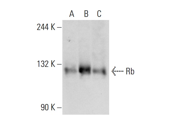  Rb (XZ55): sc-65230. Western blot analysis of Rb expression in non-transfected 293T: sc-117752 (A), human Rb transfected 293T: sc-159907 (B) and K-562 (C) whole cell lysates.