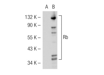  Rb (32G8): sc-69790. Western blot analysis of phosphorylated Rb expression in non-transfected: sc-117752 (A) and human Rb transfected: sc-114014 (B) 293T whole cell lysates.