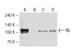  Rb (32G8): sc-69790. Western blot analysis of Rb expression in U-2 OS (A), Saos-2 (B), SK-N-MC (C) and 293T (D) whole cell lysates.