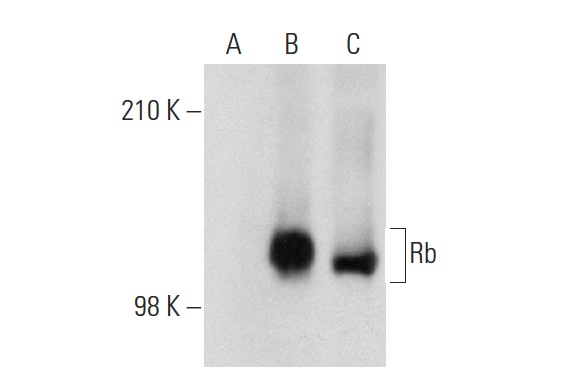  Rb (32G8): sc-69790. Western blot analysis of Rb expression in non-transfected 293T: sc-117752 (A), human Rb transfected 293T: sc-159907 (B) and ARPE-19 (C) whole cell lysates.